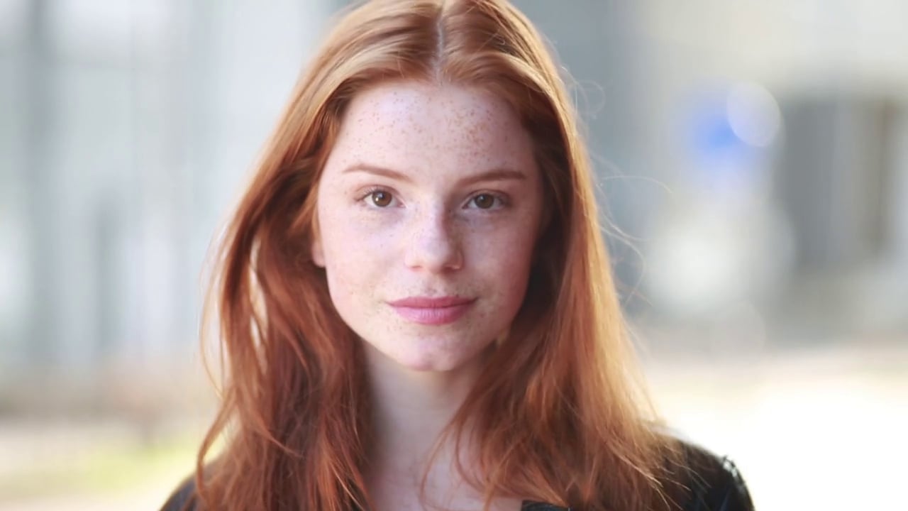 Polycystic Ovaries - Resveratrol reduces testosterone