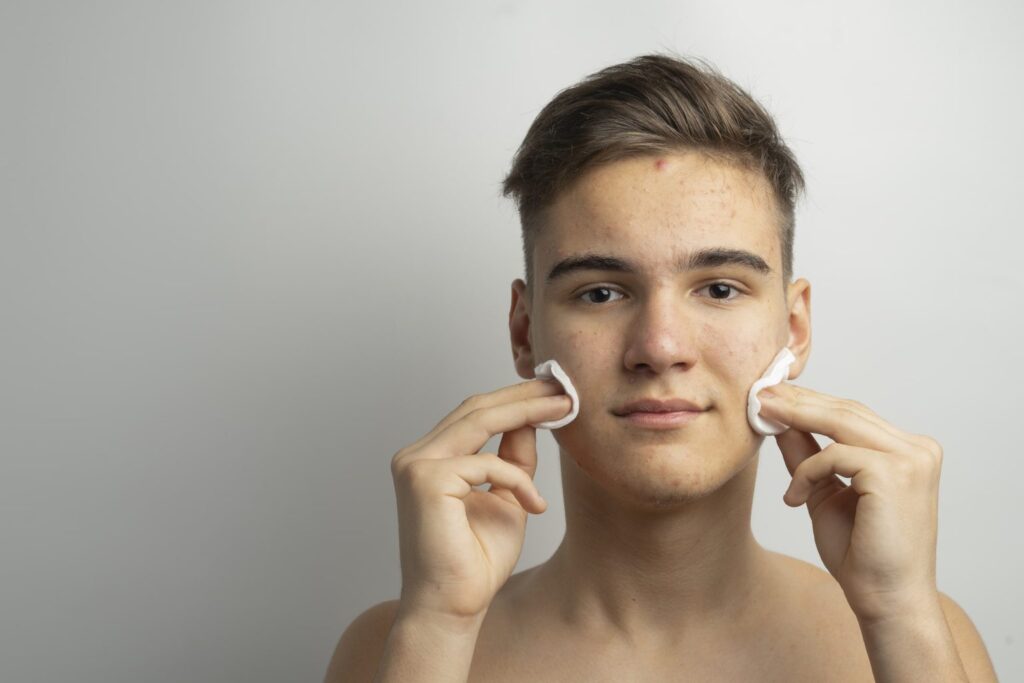 What is the Best Acne Treatment Solution?