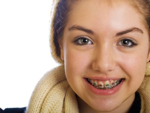 Teenager girl with braces